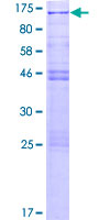 Recombinant Human CSRP2BP protein