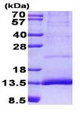 SDS-PAGE - Recombinant Human CST11 protein (denatured) (His tag N-Terminus) (AB156753)