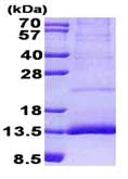 SDS-PAGE - Recombinant Human CST11 protein (denatured) (His tag N-Terminus) (AB156753)