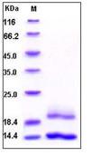 SDS-PAGE - Recombinant Human CST6 protein (His tag) (AB276268)