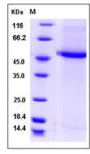 SDS-PAGE - Recombinant Human CST9L protein (Fc Chimera) (AB276520)
