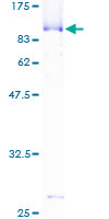 Recombinant Human CstF-64 protein