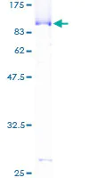SDS-PAGE - Recombinant Human CstF-64 protein (AB158223)