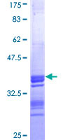 Recombinant Human CT B protein