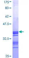 SDS-PAGE - Recombinant Human CT B protein (GST tag N-Terminus) (AB160501)
