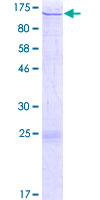 SDS-PAGE - Recombinant Human CTAGE1 protein (AB163856), expandable thumbnail
