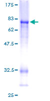 SDS-PAGE - Recombinant Human CTBP2 protein (AB114954), expandable thumbnail