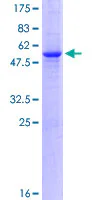 SDS-PAGE - Recombinant Human CTDSP1 protein (GST tag N-Terminus) (AB275913)