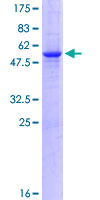 SDS-PAGE - Recombinant Human CTDSP1 protein (Tagged) (AB275913)