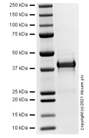 SDS-PAGE - Recombinant Human CTGF protein (AB283457)