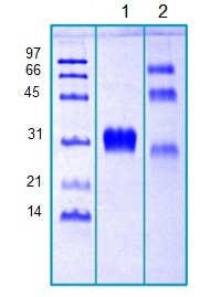 SDS-PAGE - Recombinant Human CTHRC1 protein (AB203710), expandable thumbnail