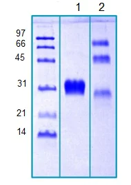 SDS-PAGE - Recombinant Human CTHRC1 protein (AB203710)
