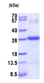 SDS-PAGE - Recombinant Human CTHRC1 protein (denatured) (AB202598), expandable thumbnail