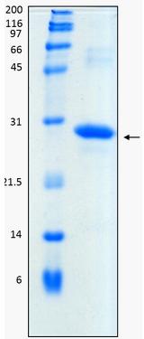 SDS-PAGE - Recombinant Human CTHRC1 protein (His tag) (AB187209), expandable thumbnail