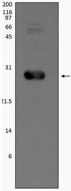 Western blot - Recombinant Human CTHRC1 protein (His tag) (AB187209)