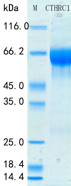 Recombinant Human CTHRC1 Protein Standard (His tag)