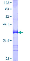 SDS-PAGE - Recombinant Human Ctip1/BCL-11A protein (AB112415)