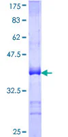 SDS-PAGE - Recombinant Human Ctip1/BCL-11A protein (GST tag N-Terminus) (AB112415)