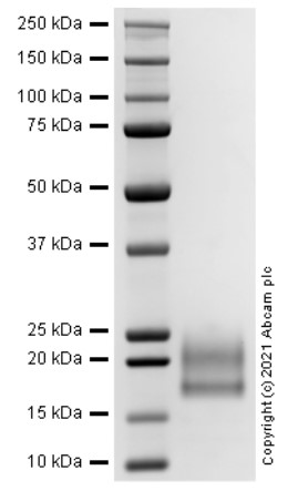 SDS-PAGE - Recombinant Human CTLA4 protein (AB283906)