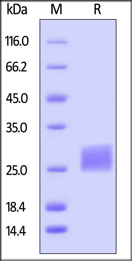 SDS-PAGE - Recombinant human CTLA4 protein (Active) (AB167727), expandable thumbnail
