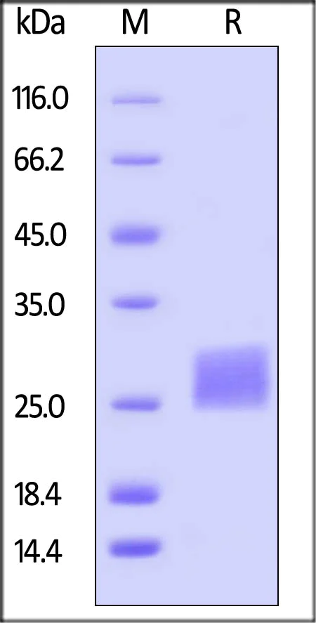 SDS-PAGE - Recombinant human CTLA4 protein (Active) (AB167727)