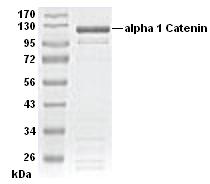 SDS-PAGE - Recombinant Human CTNNA1 protein (Tagged) (AB51443)