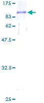 SDS-PAGE - Recombinant Human CTP synthase/CTPS protein (GST tag N-Terminus) (AB132558)