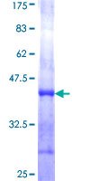 SDS-PAGE - Recombinant Human CTRL protein (AB158232), expandable thumbnail