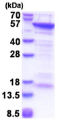 SDS-PAGE - Recombinant Human CUEDC1 protein (His tag N-Terminus) (AB174459)