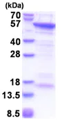 SDS-PAGE - Recombinant Human CUEDC1 protein (His tag N-Terminus) (AB174459)