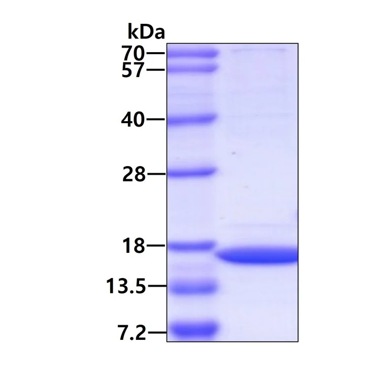SDS-PAGE - Recombinant Human CutA protein (His tag C-Terminus) (AB95345)