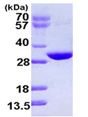 SDS-PAGE - Recombinant Human CUTC protein (AB111633), expandable thumbnail