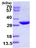 SDS-PAGE - Recombinant Human CUTC protein (AB111633)