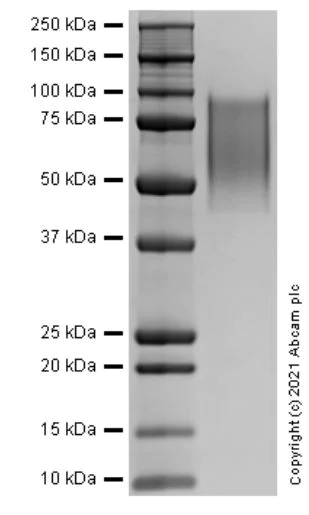 SDS-PAGE - Recombinant Human CX3CL1/Fractalkine (Chemokine Domain) protein (AB283874)