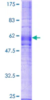 SDS-PAGE - Recombinant Human CX3CR1 protein (AB112276)