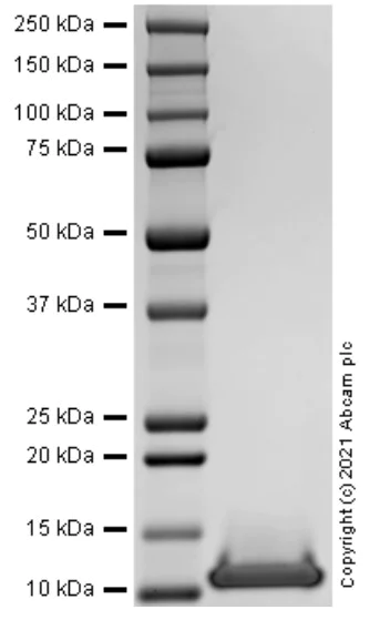 SDS-PAGE - Recombinant Human CXCL4 protein (Active) (AB283898)