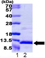 SDS-PAGE - Recombinant Human CXCL7/PBP protein (AB109834), expandable thumbnail
