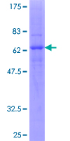SDS-PAGE - Recombinant Human CXCR2 protein (AB112309)