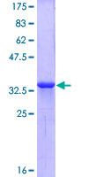 Recombinant Human CXCR4 protein