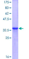 SDS-PAGE - Recombinant Human CXCR4 protein (AB159899)