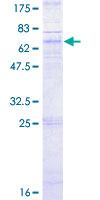 SDS-PAGE - Recombinant Human CXCR5 protein (AB157964)