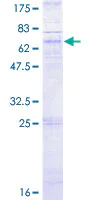 SDS-PAGE - Recombinant Human CXCR5 protein (AB157964)