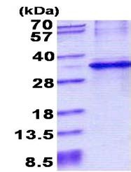 SDS-PAGE - Recombinant Human CYB5R1 protein (His tag N-Terminus) (AB156728)