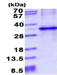SDS-PAGE - Recombinant Human CYB5R1 protein (His tag N-Terminus) (AB156728)