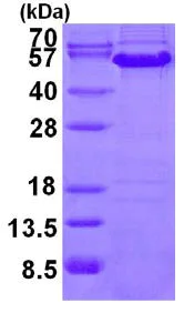 SDS-PAGE - Recombinant Human Cyclin A2 protein (His tag N-Terminus) (AB126696)