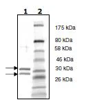SDS-PAGE - Recombinant Human Cyclin D1 + Cdk4 (mutated T172A, 43G-47G to EE) protein (Tag Free, His tag C-Term) (AB271457)