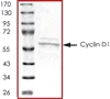 SDS-PAGE - Recombinant Human Cyclin D1 protein (GST tag N-Terminus + His tag N-Terminus) (AB85247)