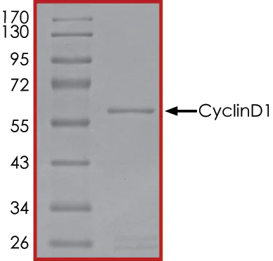 SDS-PAGE - Recombinant Human Cyclin D1 protein (Tagged) (AB268435)