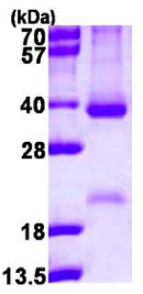 SDS-PAGE - Recombinant Human Cyclin D2 protein (denatured) (His tag N-Terminus) (AB116405)