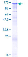 Recombinant Human Cyclin F protein